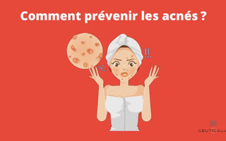 Comment prévenir les acnés ?