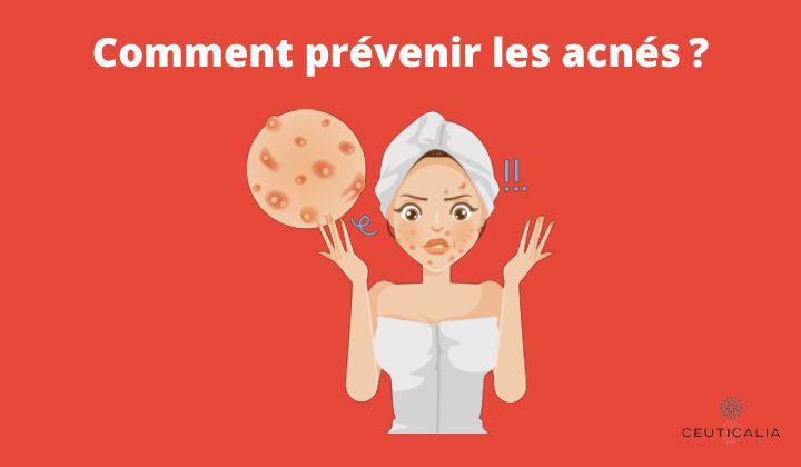 Comment prévenir les acnés ?