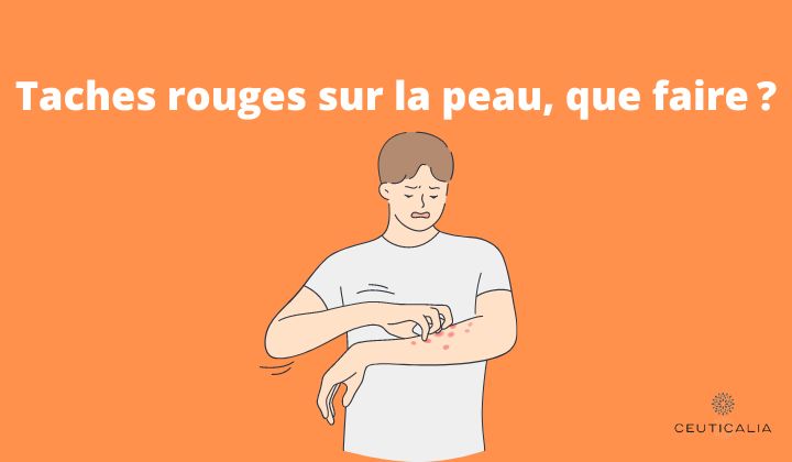 Taches rouges sur la peau, que faire ?