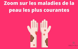 Zoom sur les maladies de la peau les plus courantes
