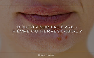 les différences entre un bouton de fièvre et un herpès labial, ainsi que les méthodes pour les reconnaître, les traiter et les prévenir.