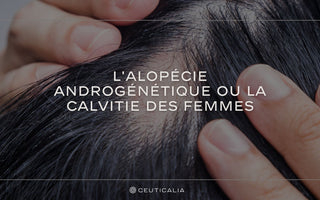 alopécie androgénétique, calvitie des femmes, perte de cheveux